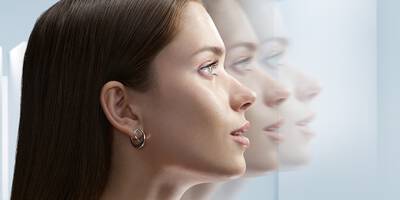 what causes wrinkles