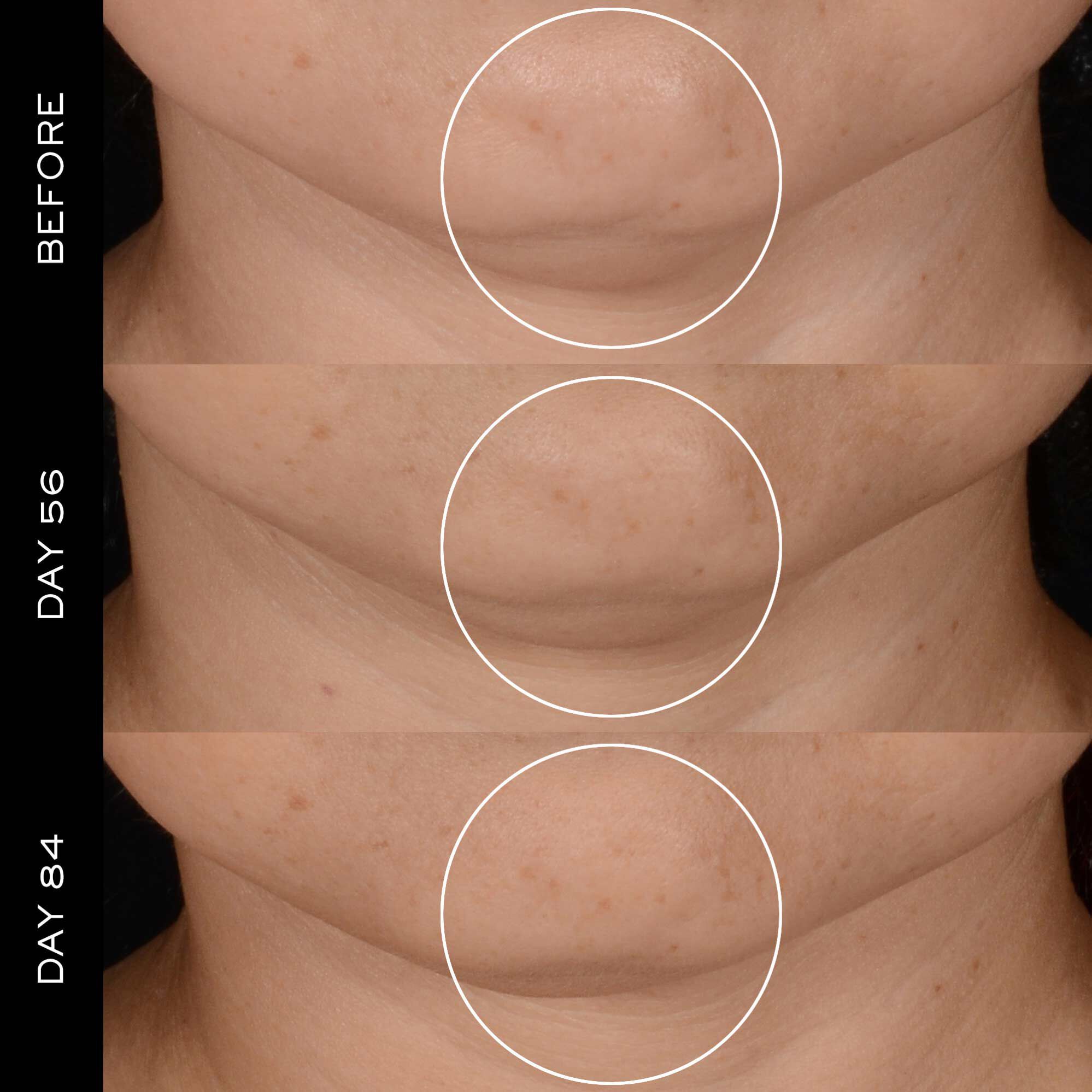 Peptide Moisturiser: Before and after result