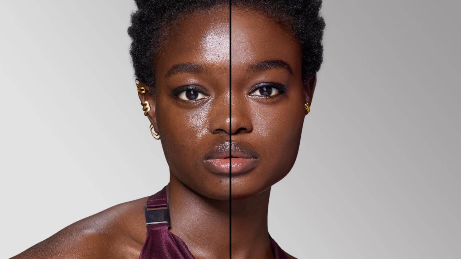 BEFORE/AFTER