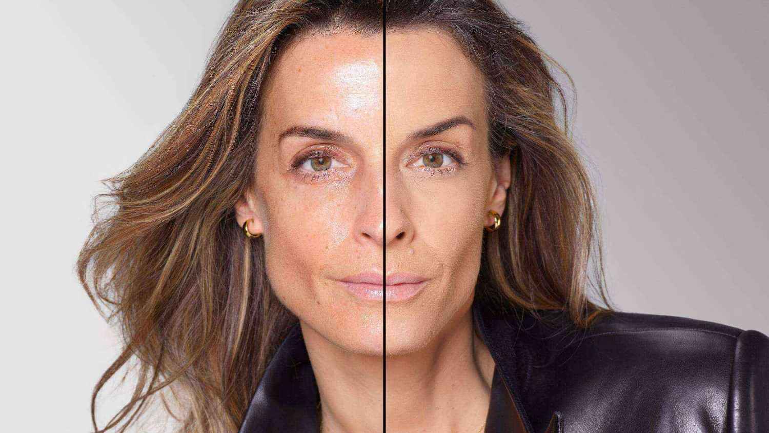 BEFORE/AFTER