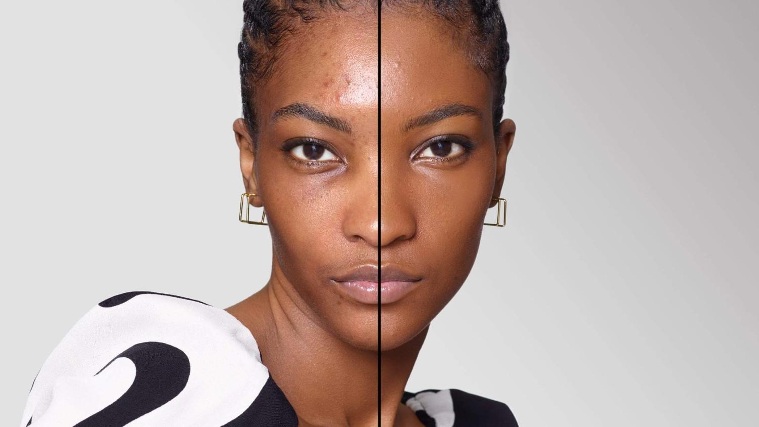 BEFORE/AFTER