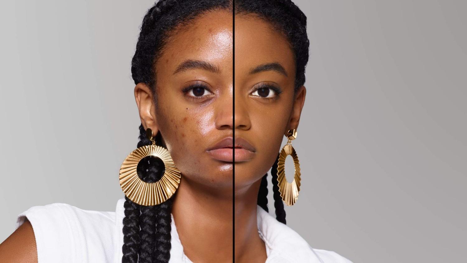 BEFORE/AFTER
