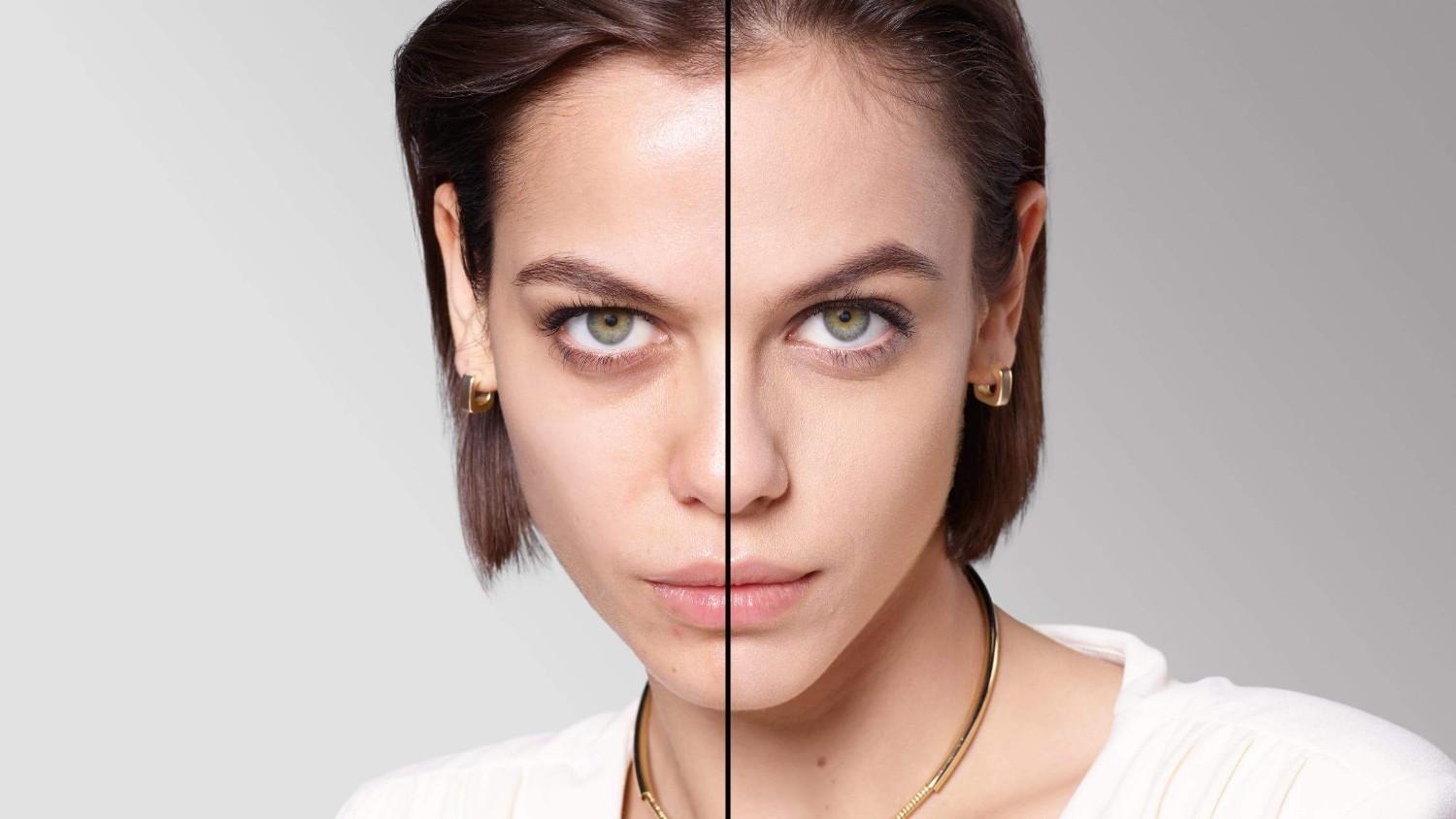 BEFORE/AFTER