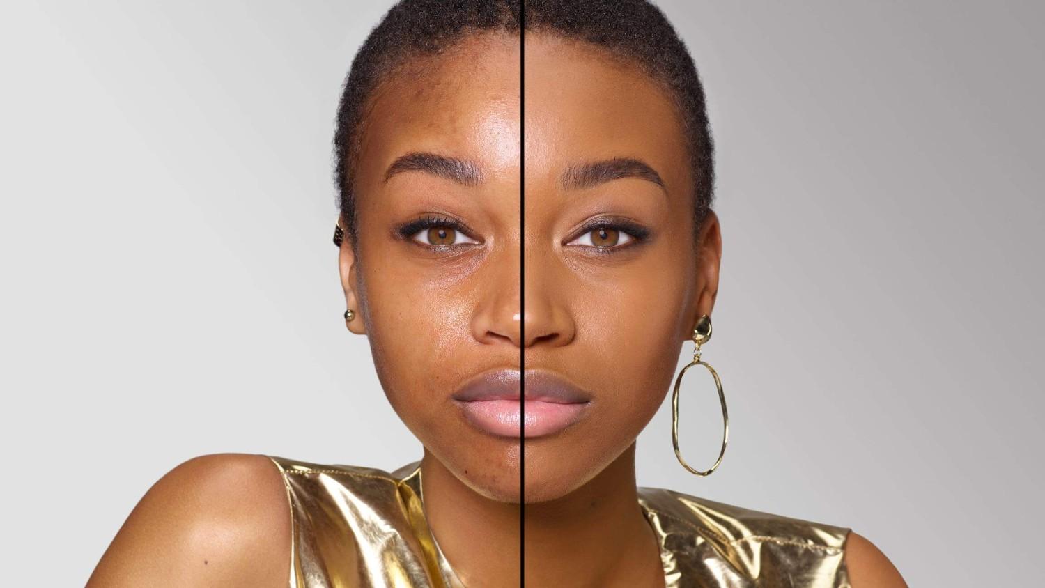 BEFORE/AFTER