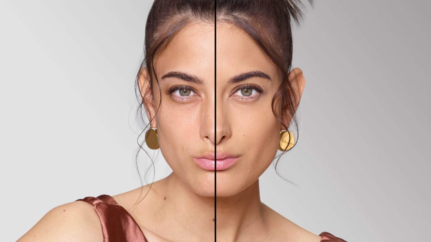 BEFORE/AFTER