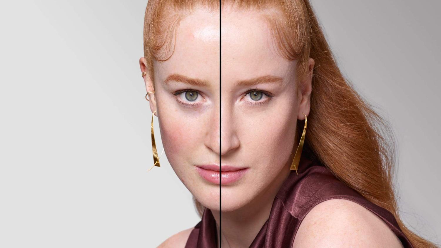 BEFORE/AFTER