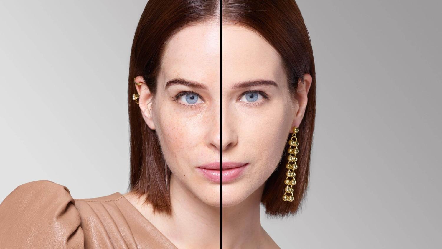 BEFORE/AFTER