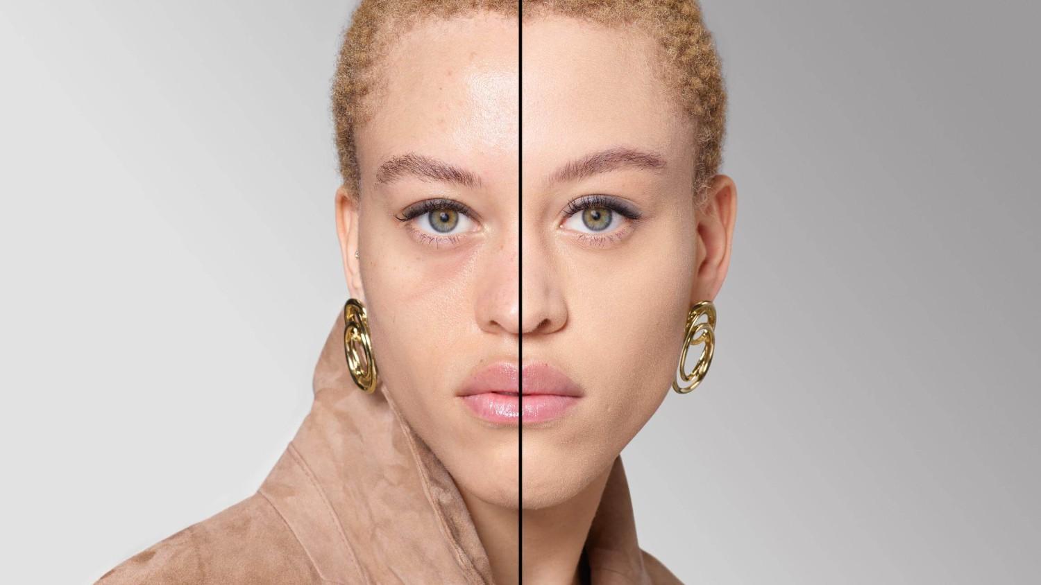 BEFORE/AFTER
