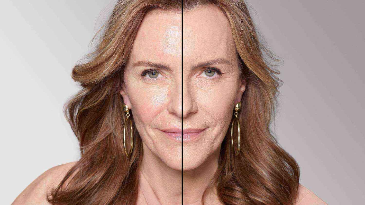 BEFORE/AFTER