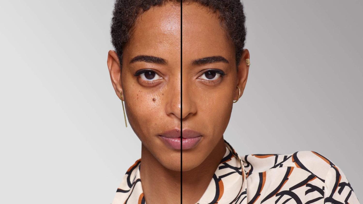 BEFORE/AFTER