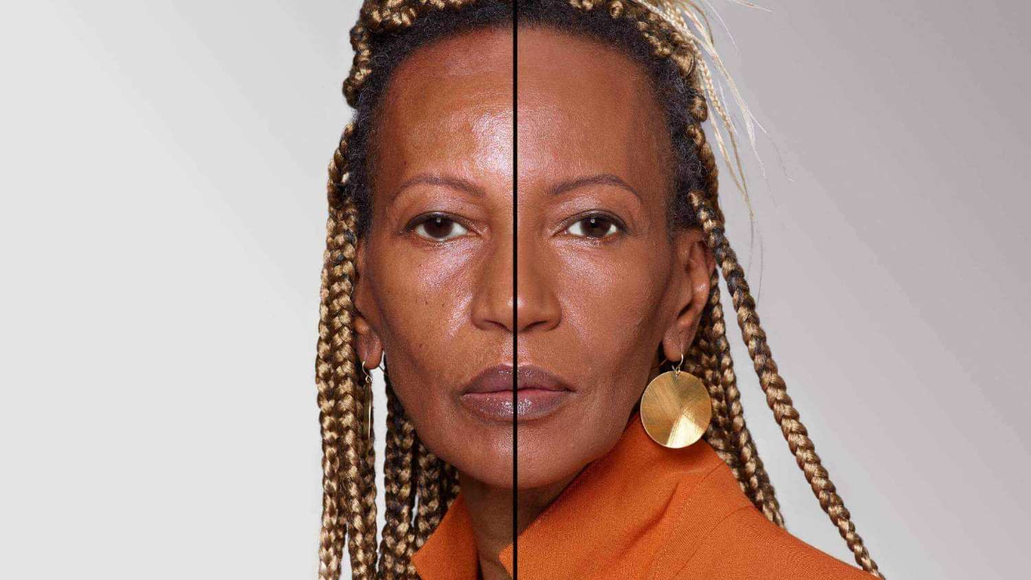 BEFORE/AFTER