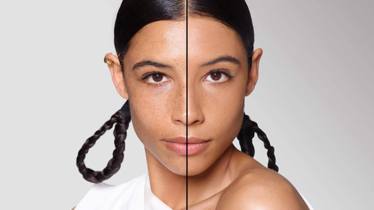 BEFORE/AFTER