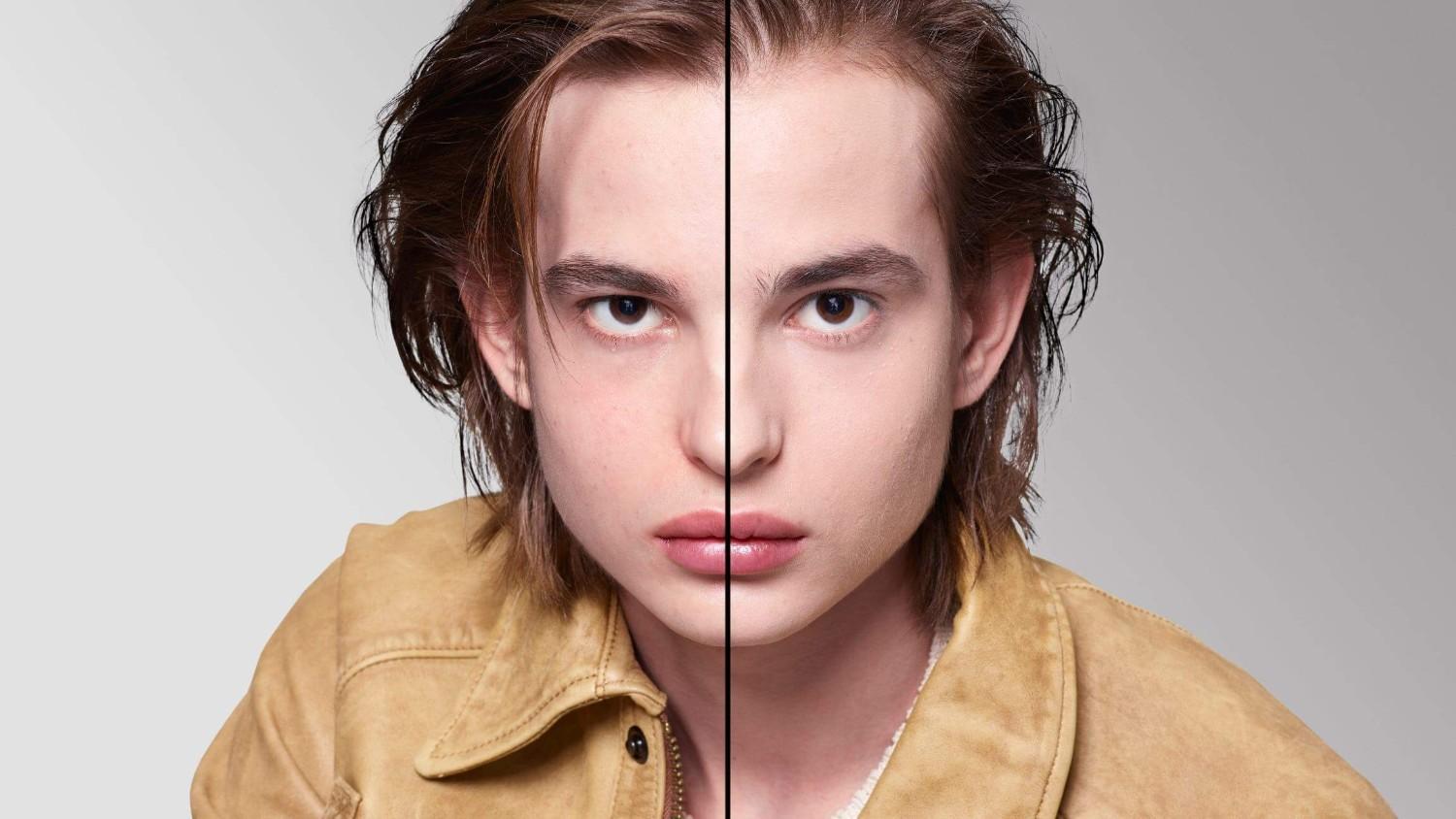 BEFORE/AFTER