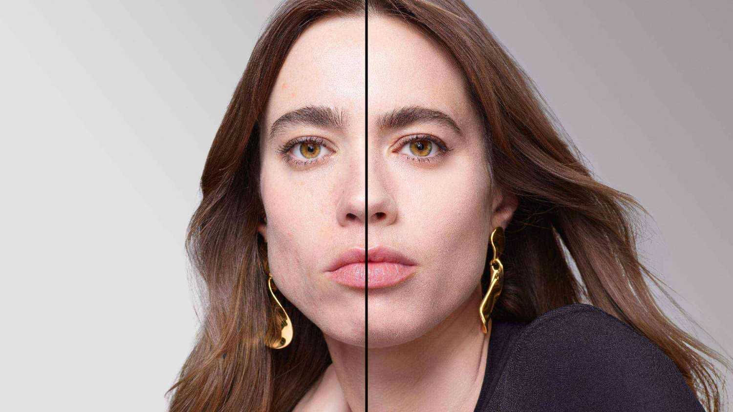 BEFORE/AFTER