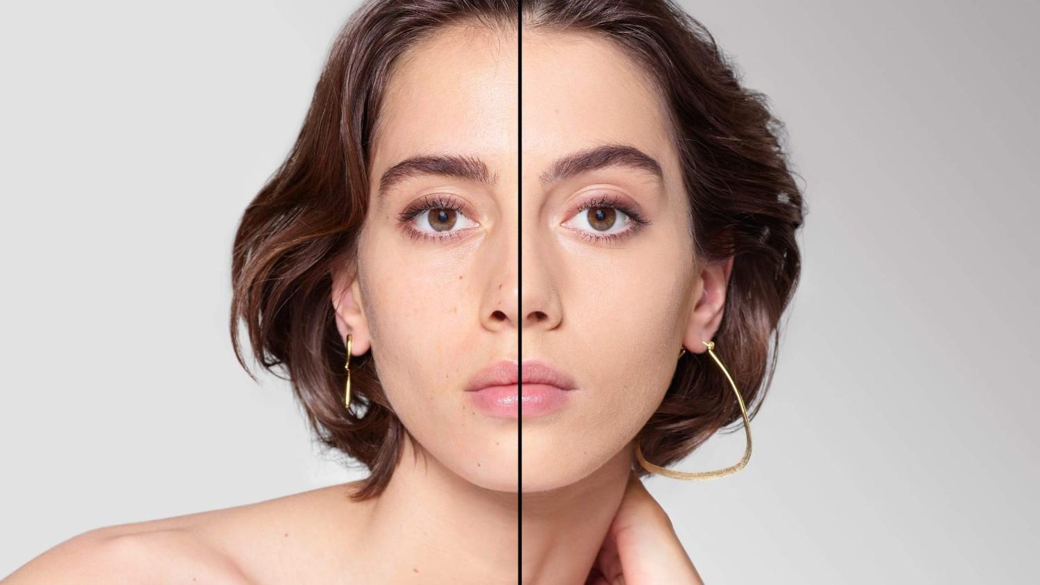 BEFORE/AFTER