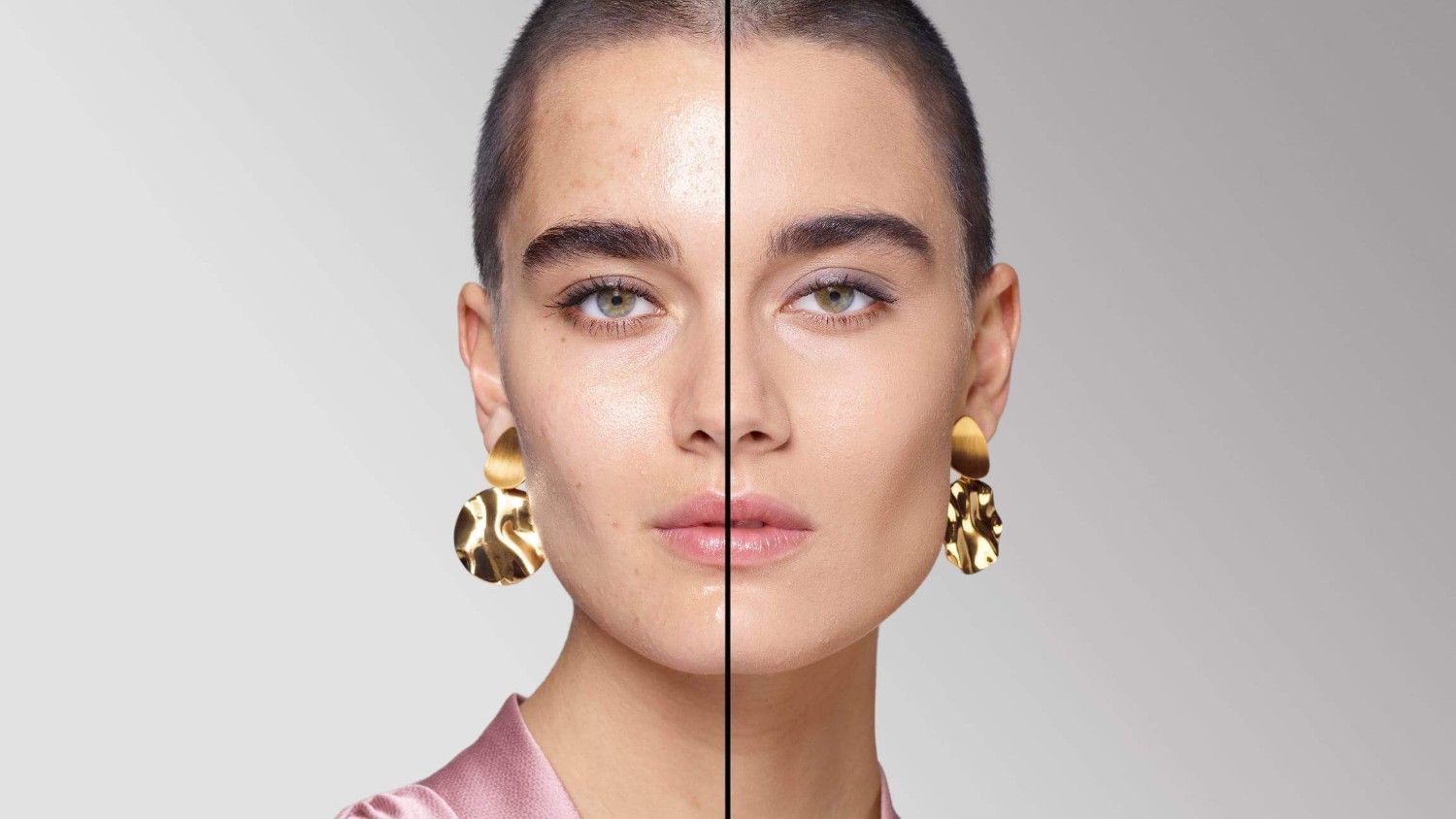 BEFORE/AFTER