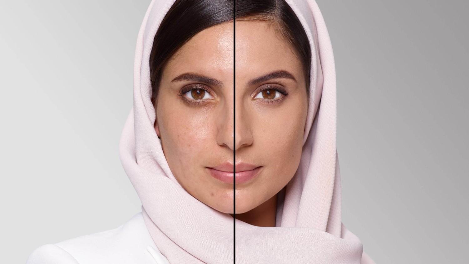 BEFORE/AFTER