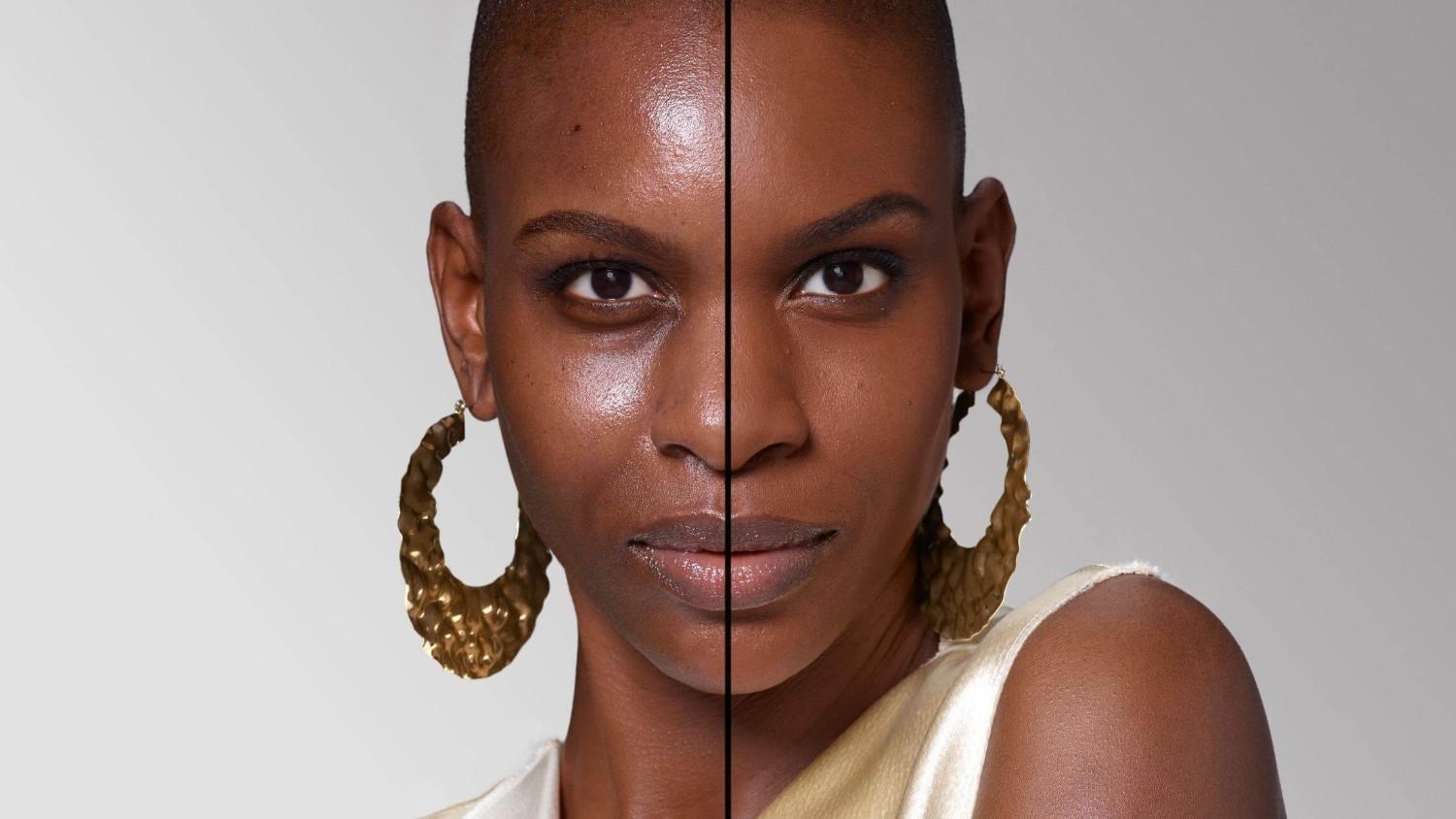 BEFORE/AFTER