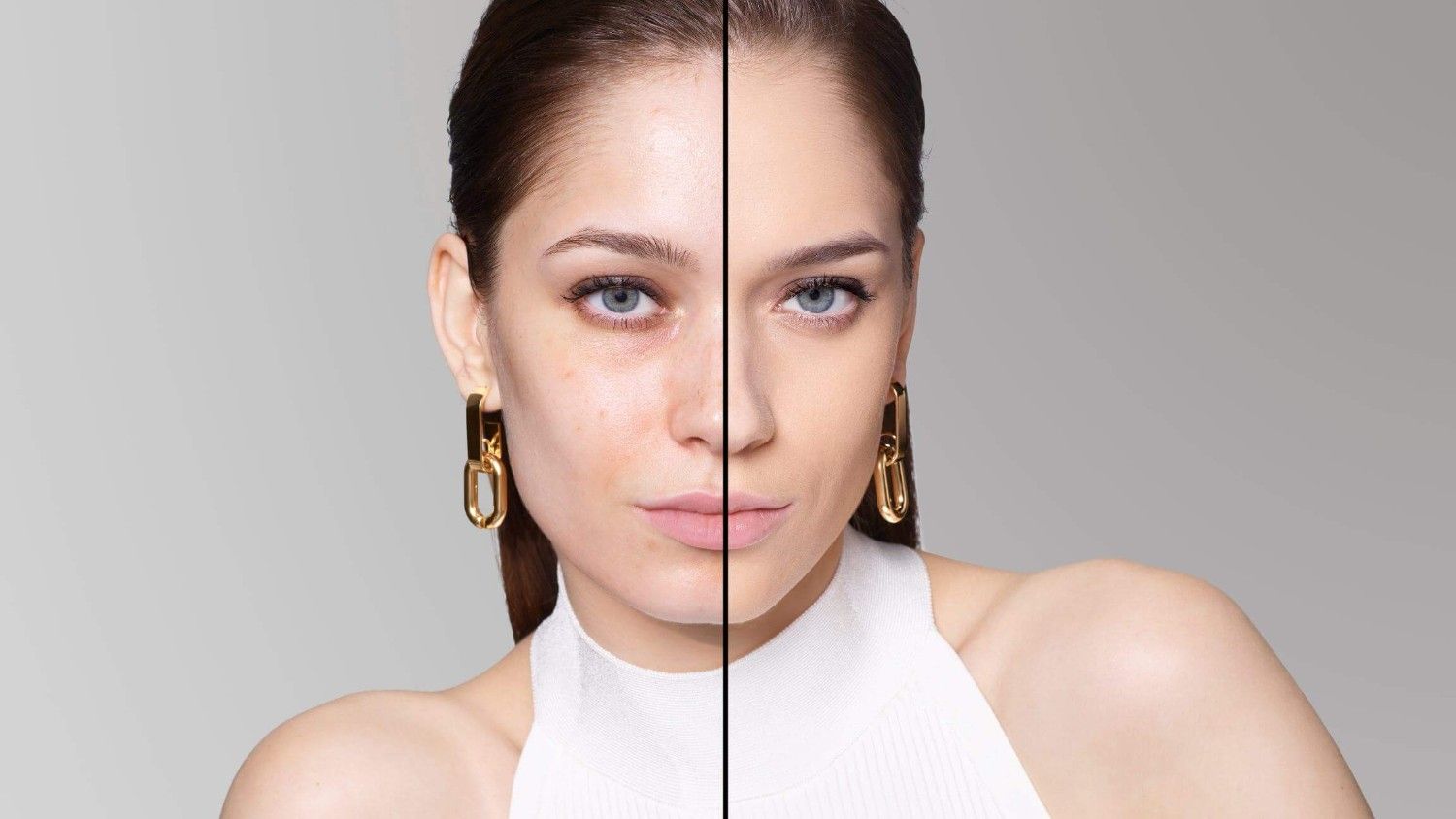 BEFORE/AFTER