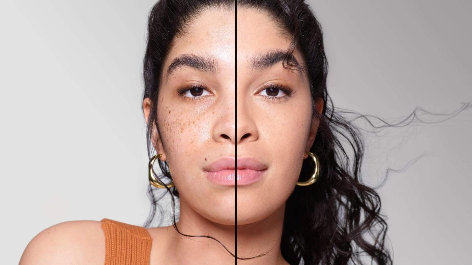 BEFORE/AFTER